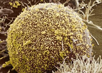 A Woman Is Cured of H.I.V. Using a Novel Treatment