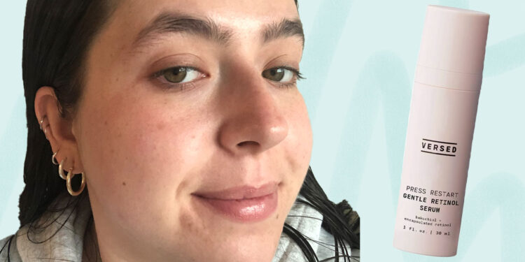 In Your 20s? Here Are the Retinol Benefits You Should Know