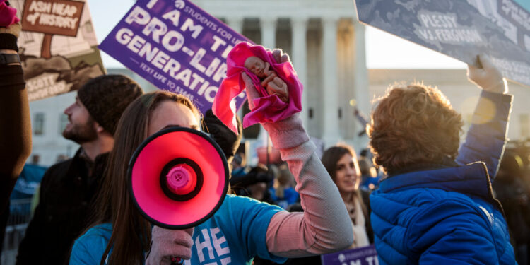 Opinion | Why the 14th Amendment Should Protect Fetal Life