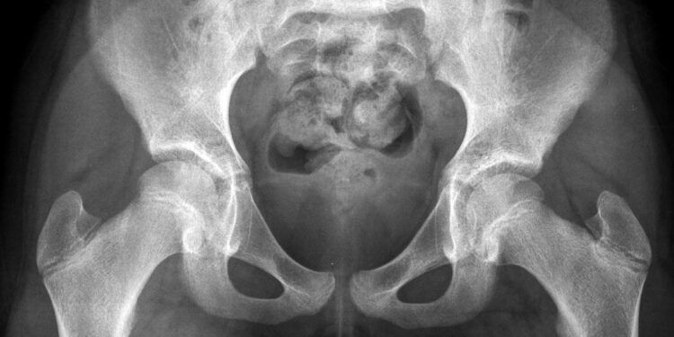 What Pregnancy and Childbirth Do to the Bodies of Young Girls