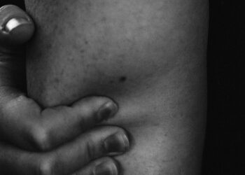 Opinion | Why Is the Right Making Women Who Miscarry Suffer?