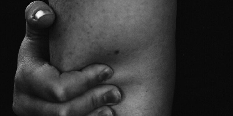 Opinion | Why Is the Right Making Women Who Miscarry Suffer?