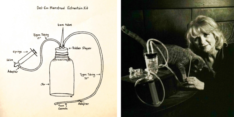 Abortion How-To: The Ms. Q&A on Menstrual Extraction With Carol Downer
