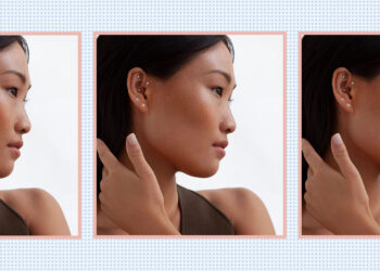 What Is “Ear Seeding” and Can It Really Improve Your Health?