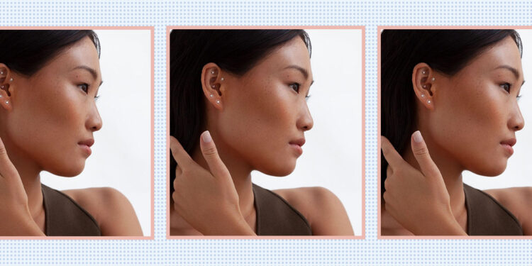 What Is “Ear Seeding” and Can It Really Improve Your Health?