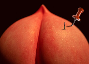 Everything You Never Wanted to Know About Hemorrhoids