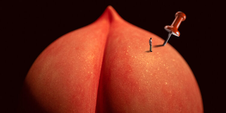 Everything You Never Wanted to Know About Hemorrhoids