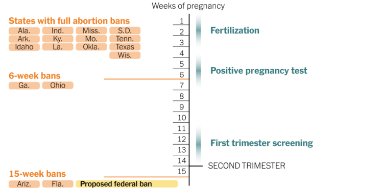 How a Nationwide Abortion Ban After 15 Weeks Would Compare to State Laws